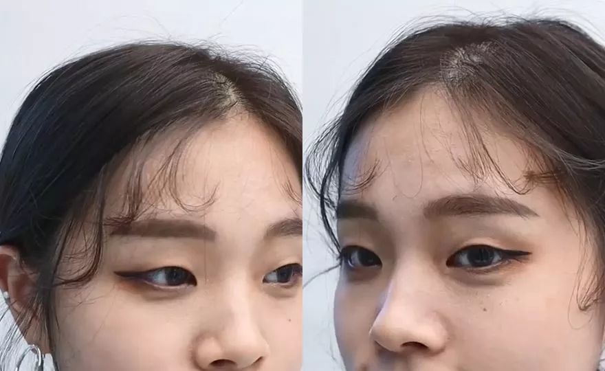 大脸额头高女生适合的发型怎么扎,高额头脸大发型设计女