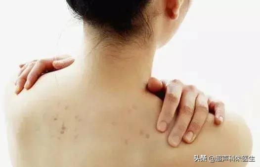 妇科疾病内裤上有什么征兆吗,有妇科炎症穿的裤子上有病菌吗