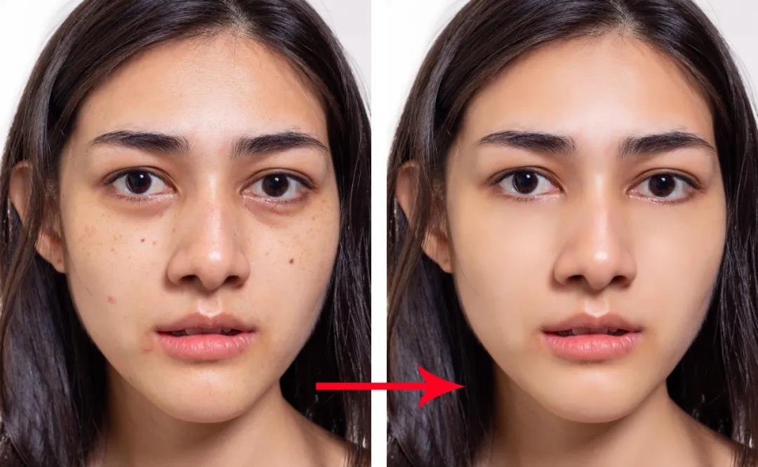 照片有黑眼圈怎么去除,照片怎么加黑眼圈