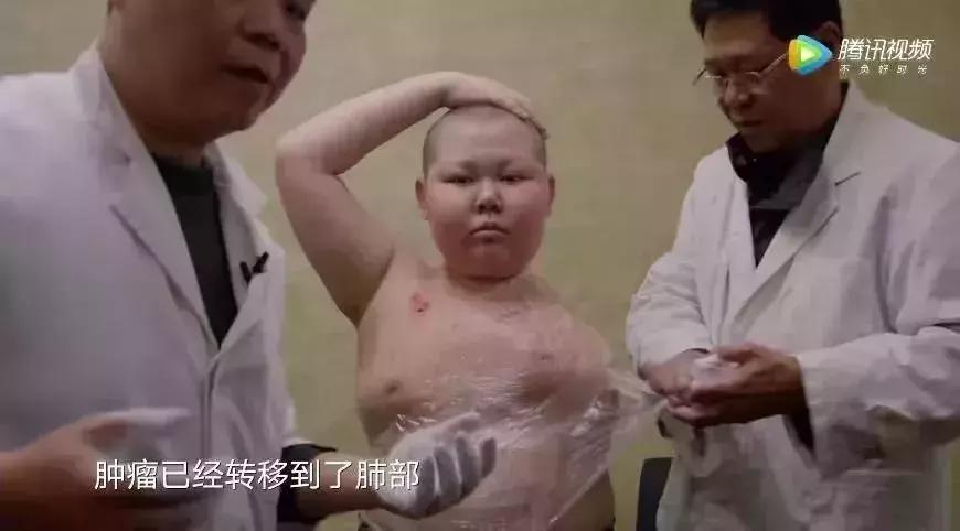 16岁少年去世捐器官,16岁少年去世后捐器官