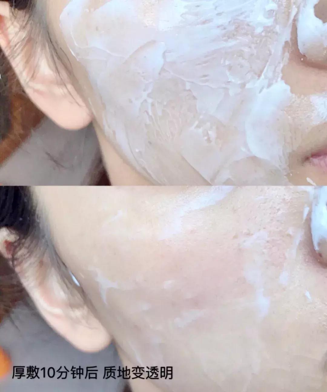 日本复活草面膜晒后修复,复活草面膜种草