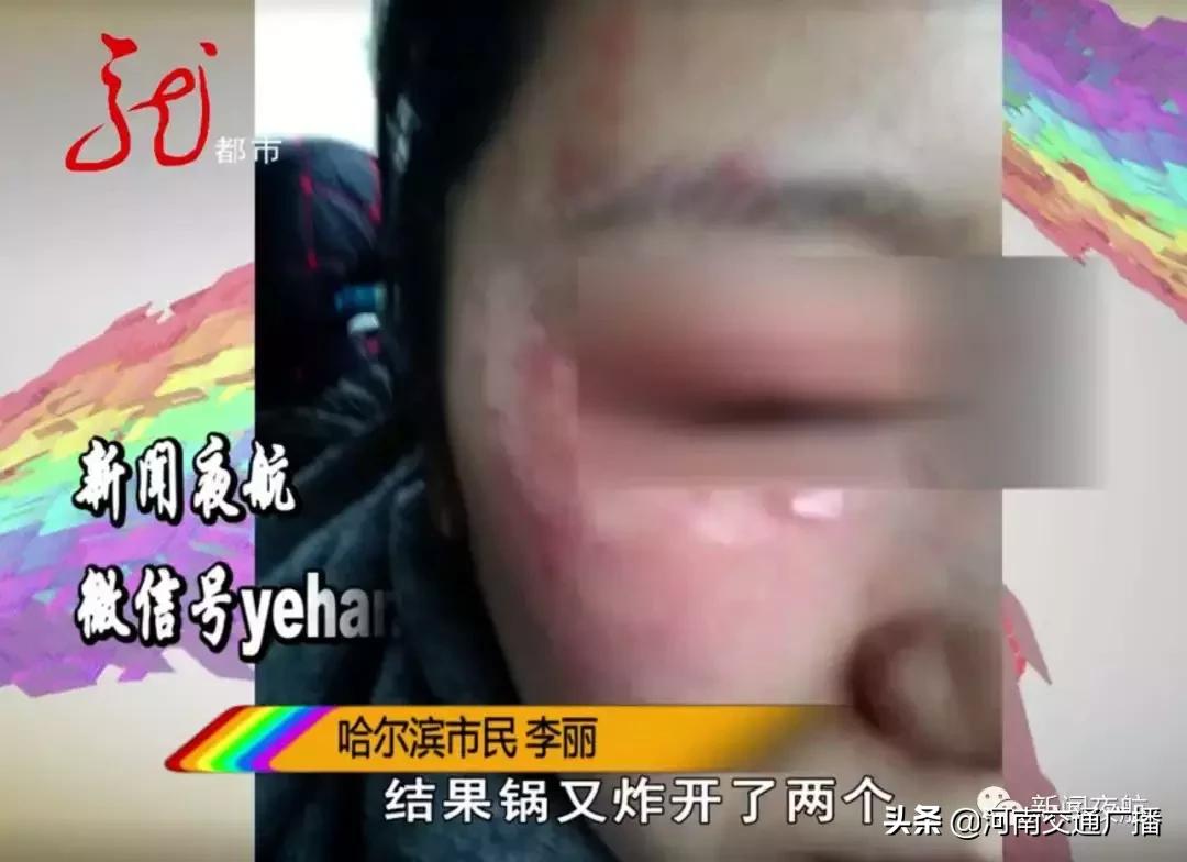 元宵突然炸开！热油四处飞溅，崩到她眼睛里！网友：又孤陋寡闻了