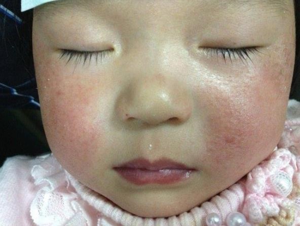 孩子总是揉眼睛用什么药,孩子总是揉眼睛眼疼怎么办