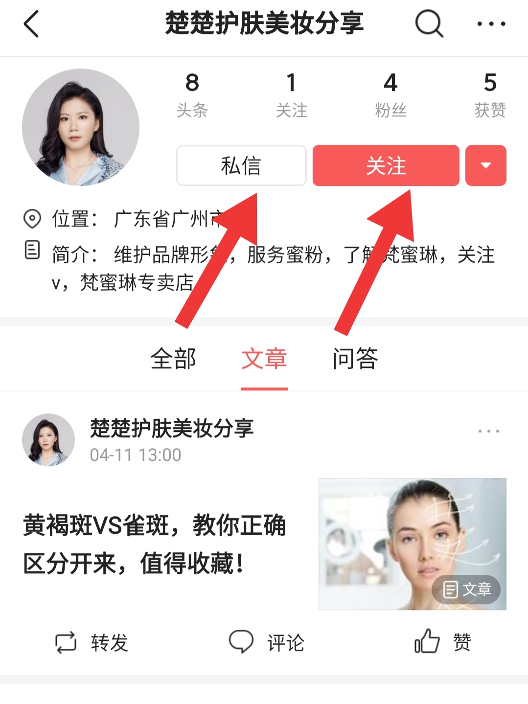 眼泪沟两个动作教您解决,泪沟是怎么形成的怎么消除眼泪沟