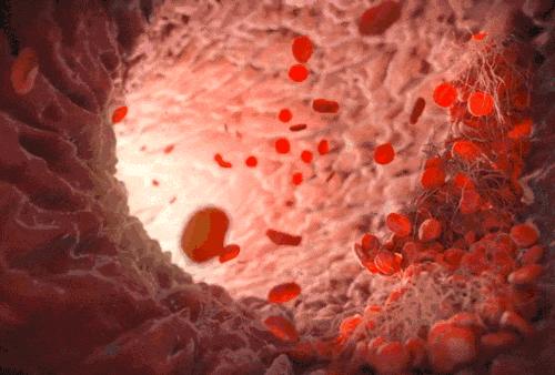 蔬菜水冲奶粉有什么危害,蔬菜水冲奶致婴儿中毒