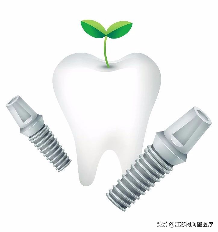 种植牙需要注意避开哪些坑,种植牙怎么选择适合自己的