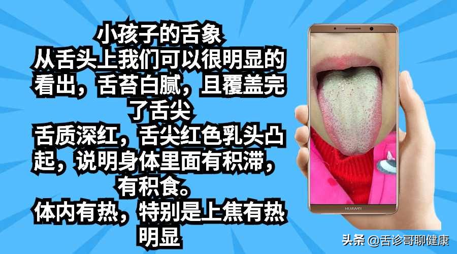 舌诊哥聊健康痰湿,抖音舌诊哥舌象分析与感悟
