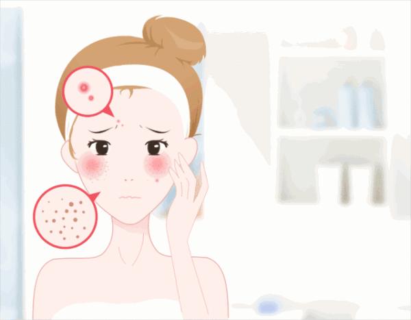 全国护肤日保护皮肤,5.25皮肤护肤日