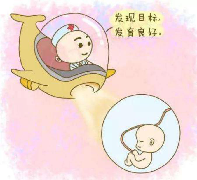 顺产和剖宫产哪个对小孩好一点,为什么很多医生都劝产妇剖腹产