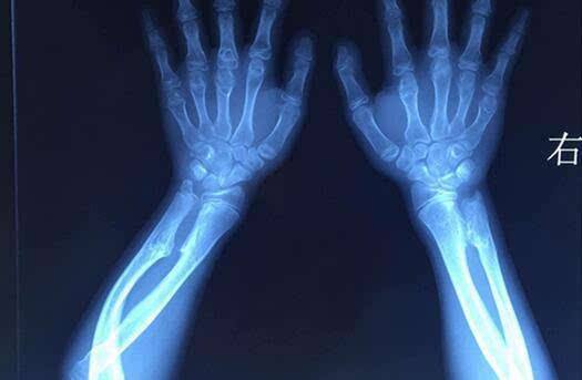 骨科知识速记口诀,如何系统的学习骨科