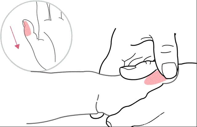 宝宝反复湿疹怎么调理消化,宝宝皮肤干燥湿疹反复怎么办