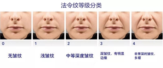 一招帮你搞定淡化法令纹,一招教你淡化法令纹