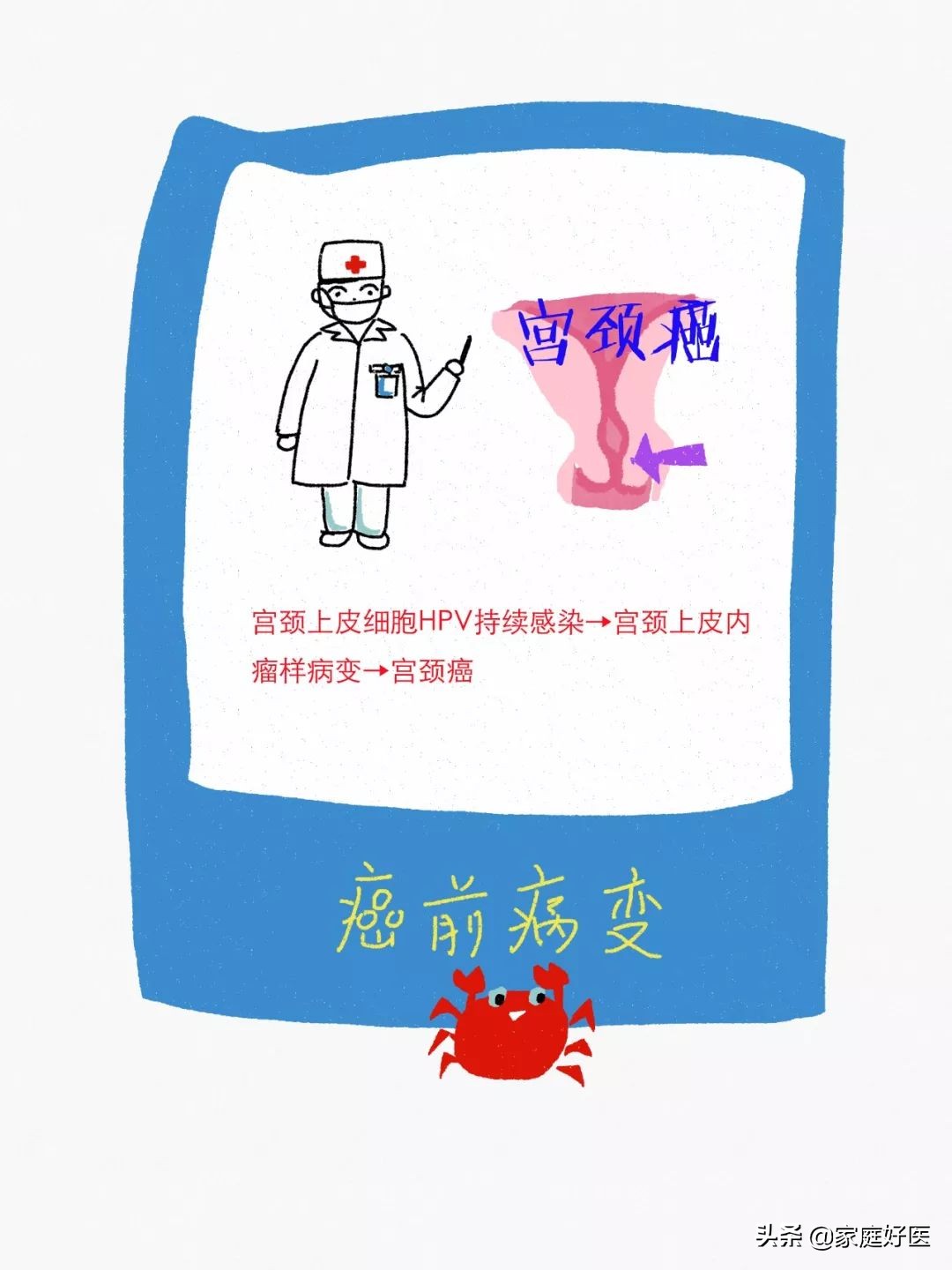 癌症来之前，都会经历癌前病变！可惜很多人没重视…​