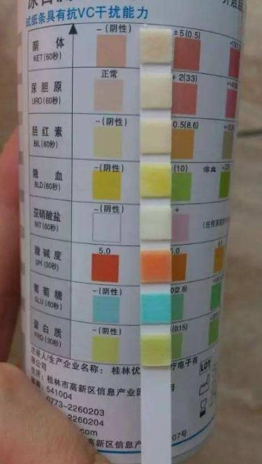 尿常规中白细胞123,尿检白细胞118多严重吗