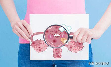 子宫内膜异位症怎么会影响肺部,子宫内膜异位症怀孕能吃泼尼松吗