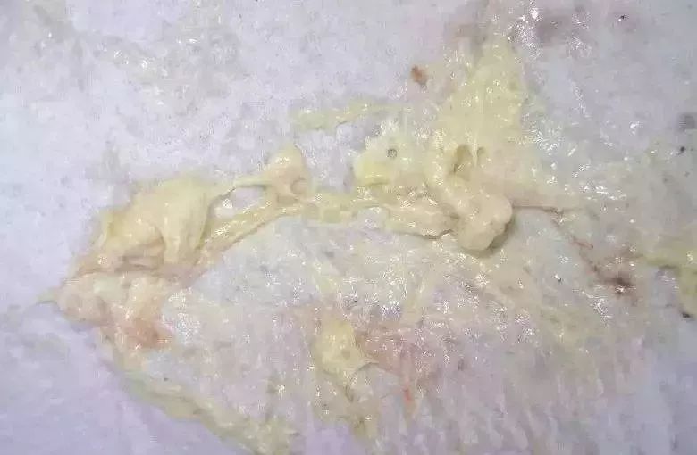 婴儿拉绿便的几种形状,宝宝拉绿便怎么鉴别