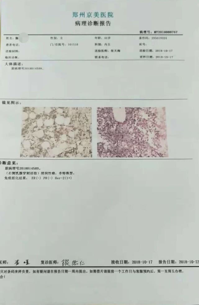 一篇真实乳腺癌病例，告诉你怎么去治疗、预防、检查