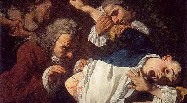 欧洲水银疗法治梅毒,放血治梅毒穴位