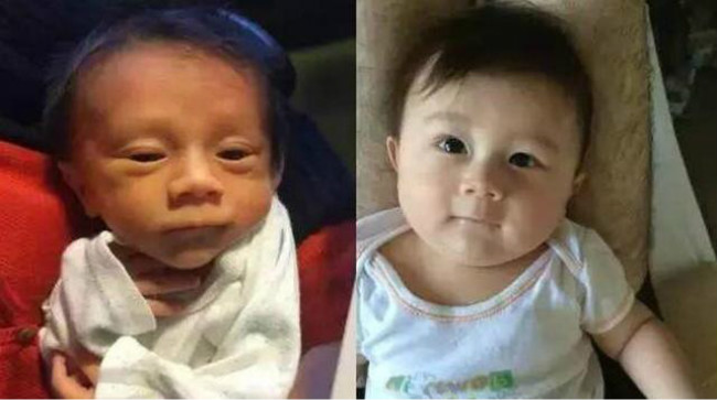 新生儿前后对比照,孩子小时候丑别急着扔掉