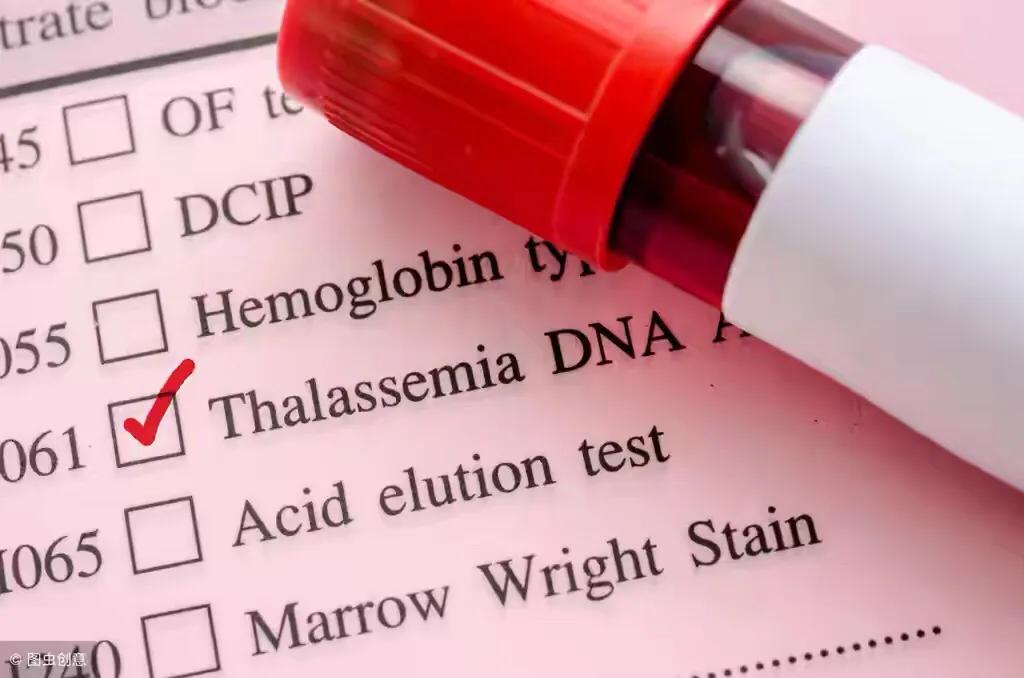 缺铁性贫血会头晕吗,缺铁性贫血血象特点