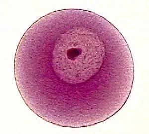 霉菌性阴道炎的引起原因,霉菌性阴道炎的原因