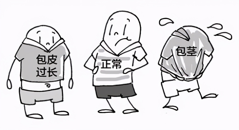 想割包皮去医院怎么说,想割包皮需要注意什么