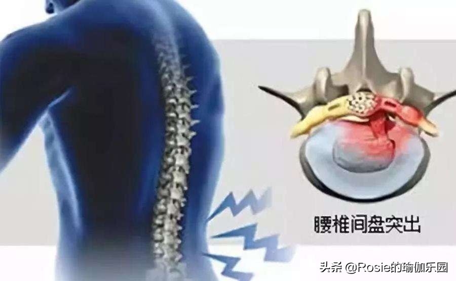 产后平躺腰疼是怎么回事,产后腰痛膝盖痛怎么锻炼