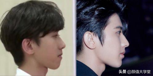 下巴后缩怎么拍侧颜,下巴后缩需要怎么矫正