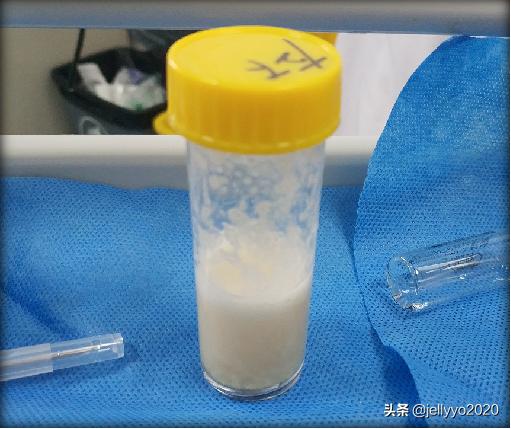 支气管镜第二次消毒多久,支气管镜肺泡灌洗怎么做的