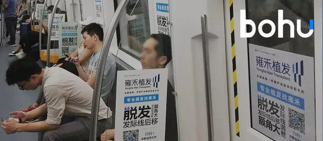 雍禾植发干细胞再生,雍禾植发脂溢性掉发能自己恢复吗