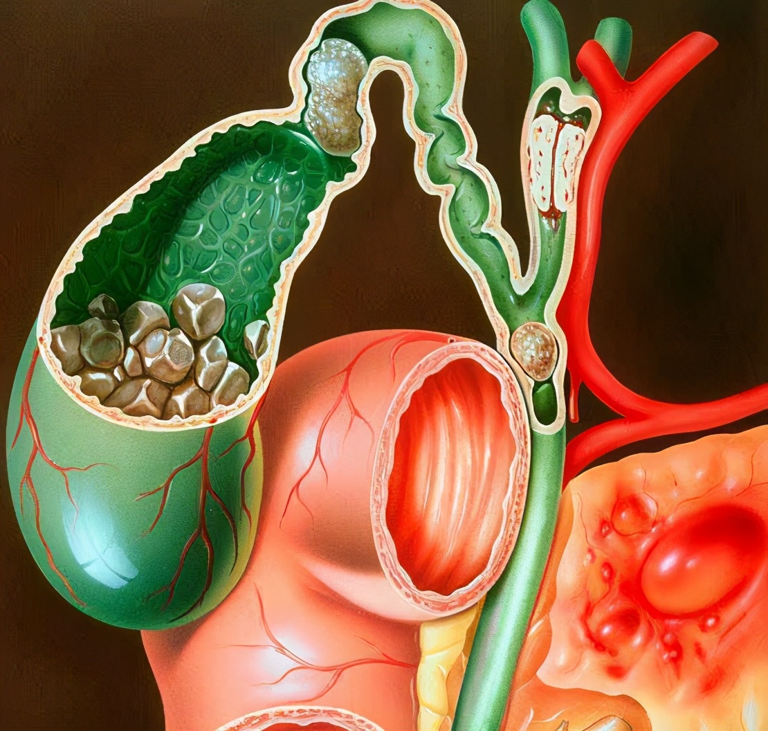 口干口苦难入睡是什么原因引起的,感冒了口干口苦是什么原因引起的