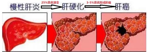 肝癌免疫靶向最新消息,肝癌免疫治疗单抗和双抗怎么选