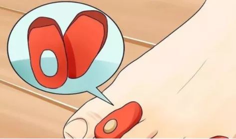 跑步脚上起水泡怎么处理好得快,脚跑步起水泡怎么处理好得快