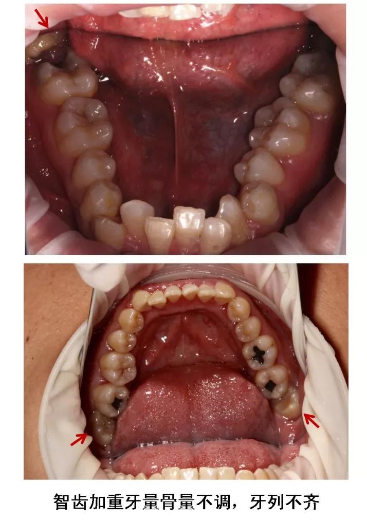 Helen榻跨涓績,helen榻跨