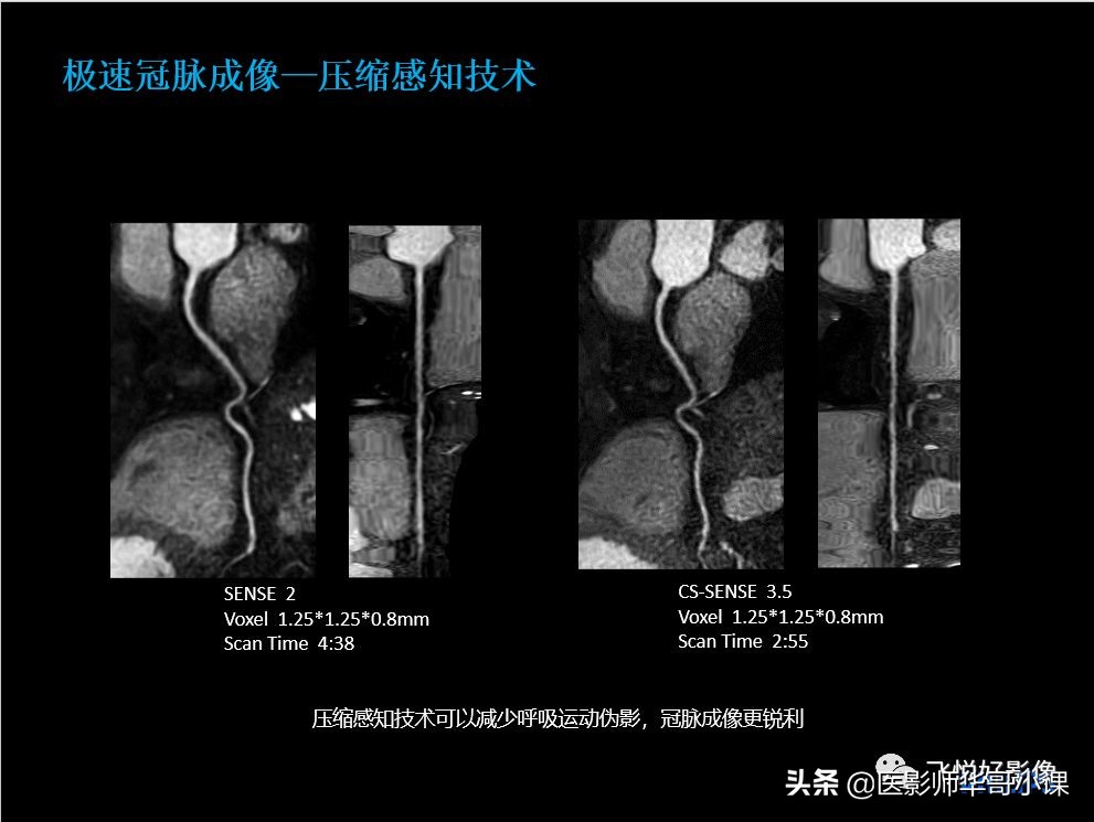 飞利浦多磁源核磁共振,飞利浦磁共振图像操作