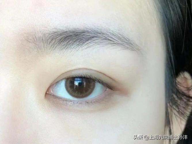 明明是双眼皮却老是不显为什么,为什么割了双眼皮反而不好看了