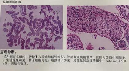 一文看懂医学影像科,一文读懂肝脏超声