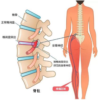 上海长征医院史国栋教授,上海长征医院史国栋简历