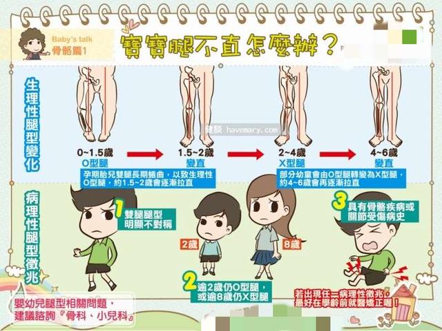 小孩是o型腿图片,孩子x型腿很严重应该怎么解决