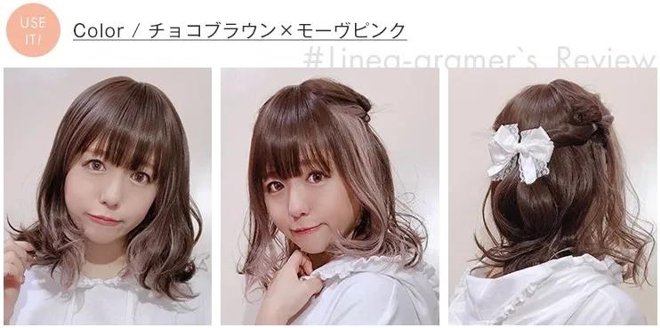 日本15岁脱毛症状,日本脱毛症