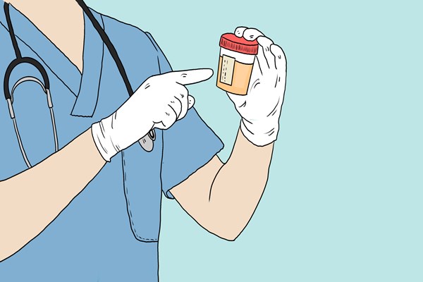 蛋白尿要怎样养肾,蛋白尿治好后应该如何护肾