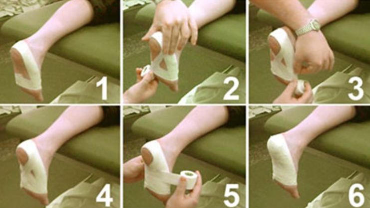 跑步跑到足跟痛，运动生涯要报废？