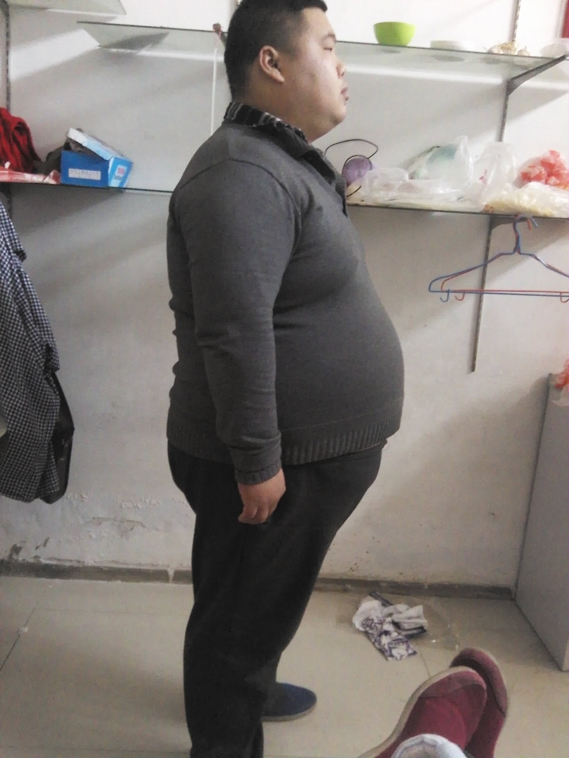 王存川减重第一人,王存川教授减重手术