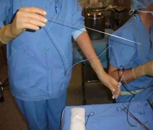 拜金的代价,花季少女堕落史!揭开捐卵黑中介的阴谋