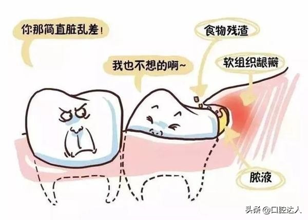 “它”可能给你的长假带来*麻大**烦!医生:早发现,早治疗