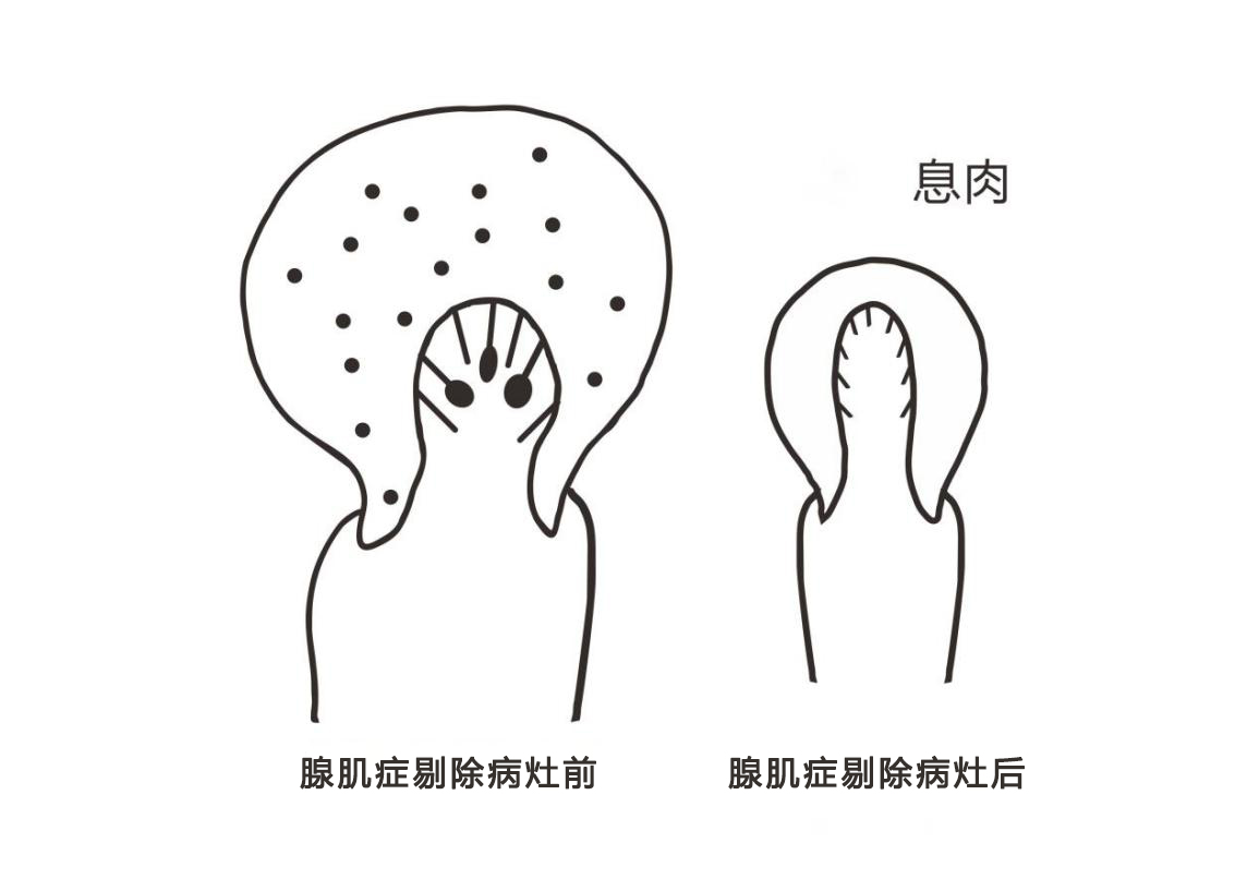 一次月经用10张卫生巾正常吗,一次例假用七片卫生巾正常吗