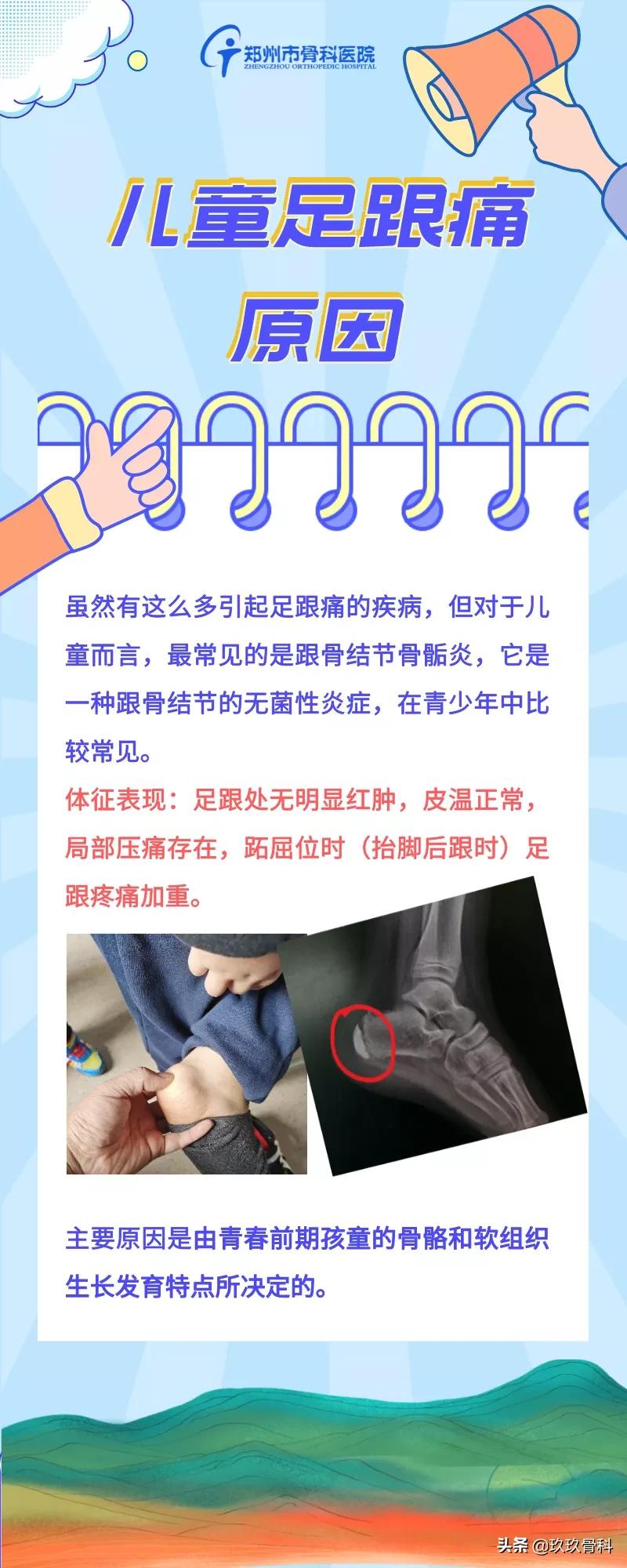 儿童脚后跟疼需要挂什么科室,儿童运动后脚后跟疼怎么回事