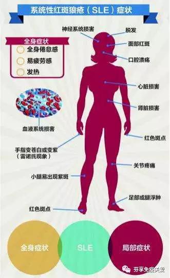sle系统性红斑狼疮临床进展,风湿免疫疾病科普小知识
