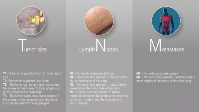 得了癌症还能活多久？能从“癌症生存率”得到答案吗？