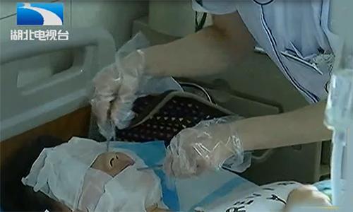 女子贴面膜毁容,女子敷面膜脸部红肿